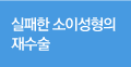 실패한 소이성형의 재수술